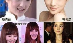 整容女星爆料视频大全最新,整容女星爆料视频大盘点，真实面目曝光！
